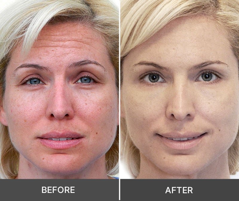 IDROTHERAPY Review 1